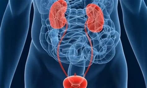 تجربتي مع المثانة العصبية تجربتي مع المثانة العصبية