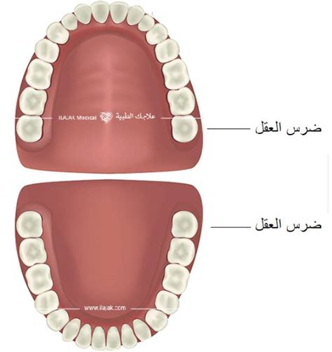 كيف اعرف ان ضرس العقل بيطلع