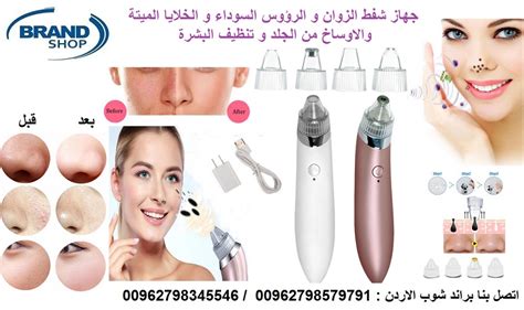 جهاز شفط الرؤوس السوداء جهاز شفط الرؤوس السوداء