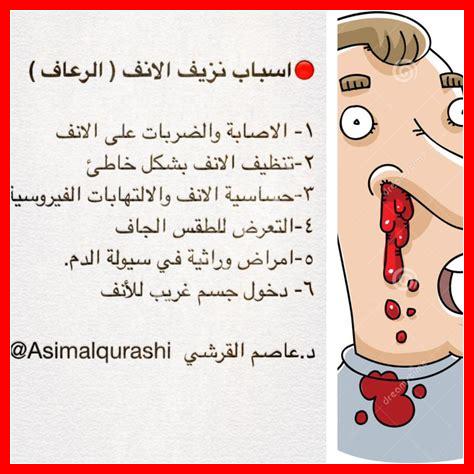 رعاف الانف اسباب