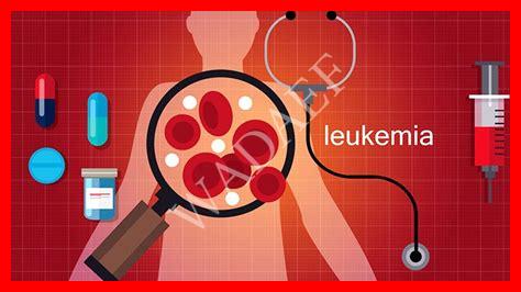 اسباب سرطان الدم اسباب سرطان الدم