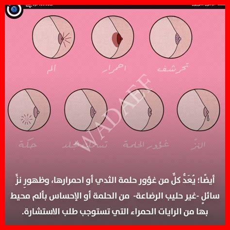 اسباب ظهور حبة في الثدي اسباب ظهور حبة في الثدي