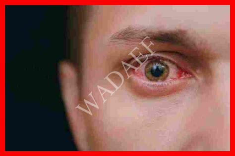 تفسير رؤية حبة في جفن العين في المنام تفسير رؤية حبة في جفن العين في المنام