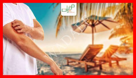 جفاف الجلد في الصيف جفاف الجلد في الصيف