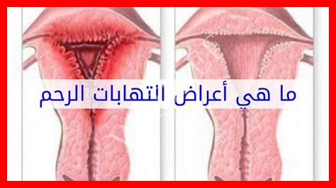 حبة في عنق حبة في عنق