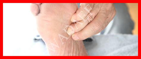 حبة في قاع القدم حبة في قاع القدم