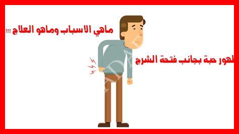 ظهور حبة في المخرج غير مؤلمة ظهور حبة في المخرج غير مؤلمة