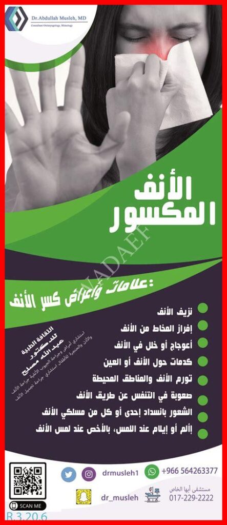 علامات كسر الانف
