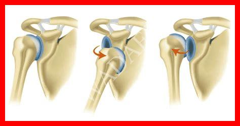 أنواع خلع الكتف أنواع خلع الكتف