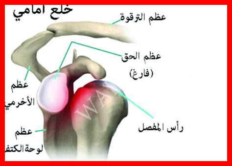 أنواع خلع الكتف أنواع خلع الكتف