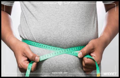 العلاج الطبيعي في حالات السمنة وفقدان الوزن