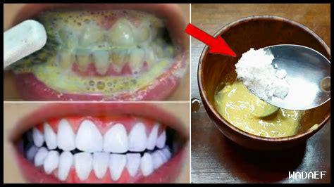 المكونات الطبيعية لتبيض الأسنان