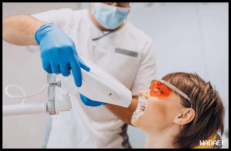 تبيض الأسنان: أسعار ونتائج مثيرة للاهتمام