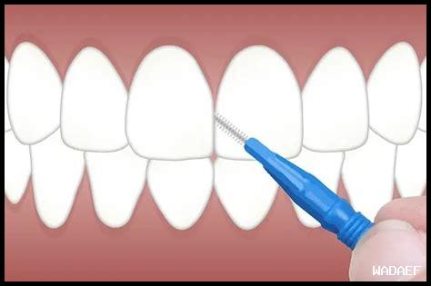 تبيض الأسنان: كيفية الحفاظ على النتائج
