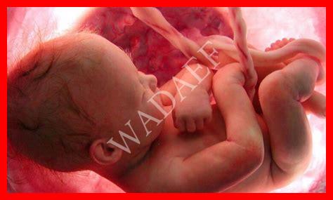 تجربتي مع زيادة الماء حول الجنين