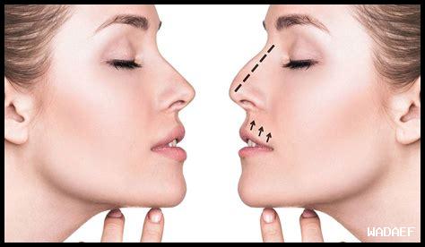 تجميل الأنف وعلاقته بأشكال الوجه