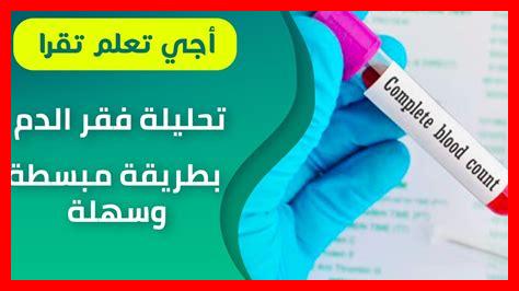 تحليلة nfs ثمن تحليلة nfs ثمن