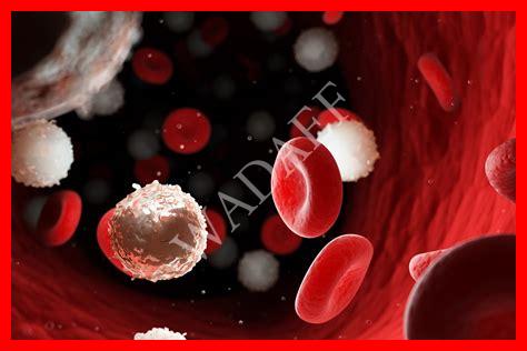 سرطان الدم أنواع سرطان الدم أنواع