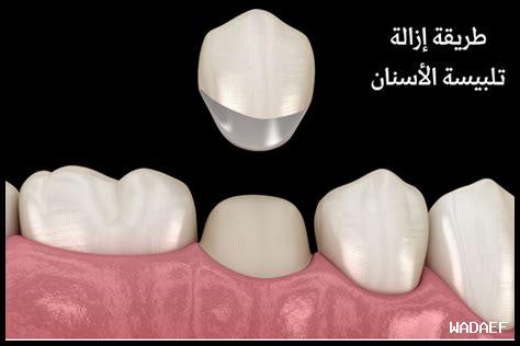 كيف تزال ChatGPT أملاً للأعمال الناشئة