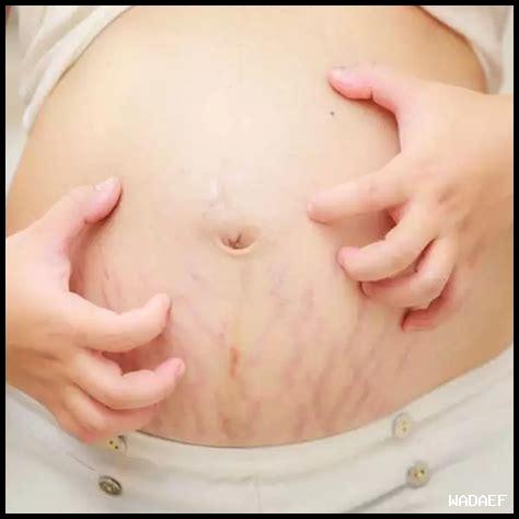 كيف تساعد كريمات الحماية في التغلب على مشاكل الجلد؟ كيف تساعد كريمات الحماية في التغلب على مشاكل الجلد؟