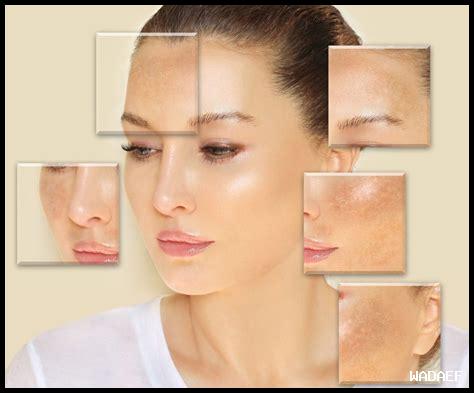 كيف يمكن معرفة ما إذا كان سيروم حمض الكوجيك مناسب لك