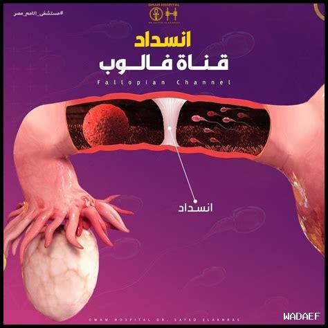 كيفية التعامل مع مشاكل قنوات فالوب