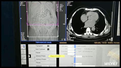 كيفية عمل الكبد وأهمية التخلص من السموم كيفية عمل الكبد وأهمية التخلص من السموم