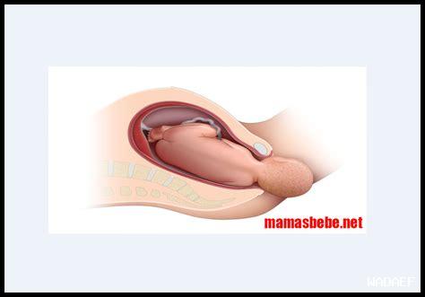 ما هي أبرز العلامات على اقتراب عاصفة رعدية؟