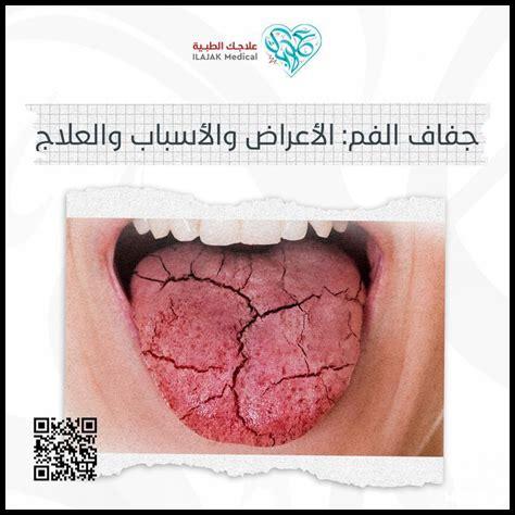 ما هي المشاكل الشائعة في ديسكورد وكيف تحلها