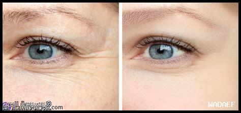 ما هي تأثيرات عدم استخدام كريم الحماية على الصحة الجلدية؟ ما هي تأثيرات عدم استخدام كريم الحماية على الصحة الجلدية؟