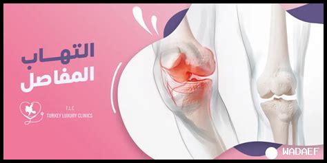 مرض التهاب المفاصل: الأنواع والأعراض والعلاج