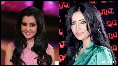 نفخ الخدود: نصائح قبل وبعد العملية نفخ الخدود: نصائح قبل وبعد العملية