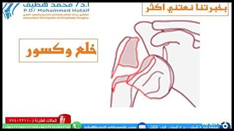 هل تريد معرفة المطاعم القريبة التي تعمل حتى وقت متأخر