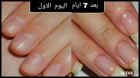 وصفات طبيعية لتطويل الأظافر بسرعة وصفات طبيعية لتطويل الأظافر بسرعة