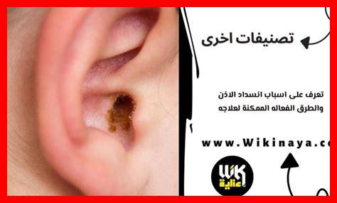 أسباب انسداد الطرق في راس تنورة اليوم أسباب انسداد الطرق في راس تنورة اليوم