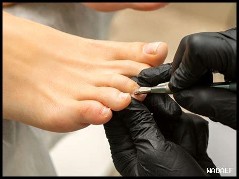 خلع الظفر في المنام بدون ألم