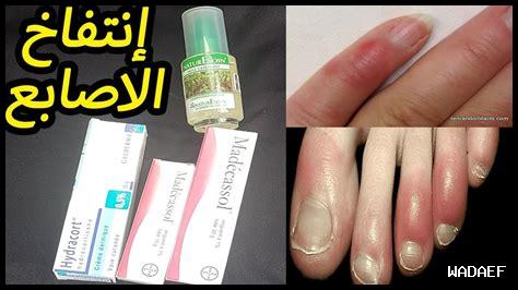 دواء رعشة اليدين