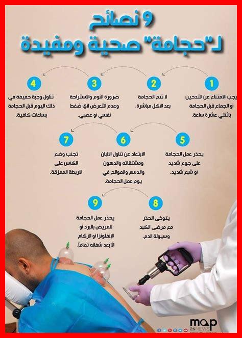 رعشة بعد الحجامة رعشة بعد الحجامة