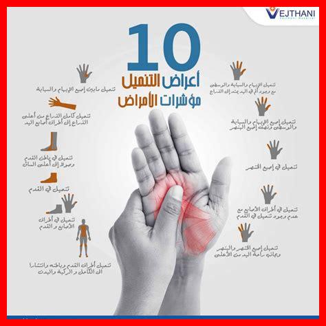 رعشة كف اليد رعشة كف اليد