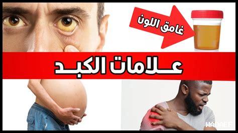 رعشة مريض الكبد رعشة مريض الكبد