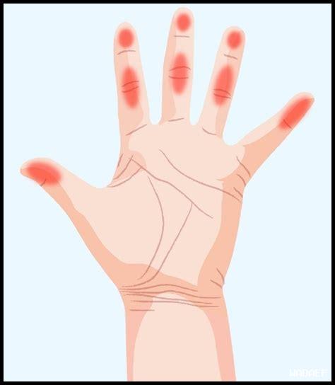 سبب رعشة اليد اليسرى