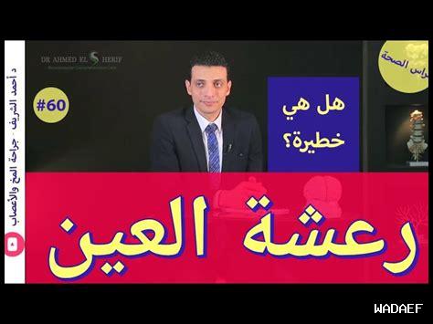 سبب رعشة جفن العين اليسرى