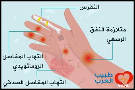 كيف تعالج رعشة اليد