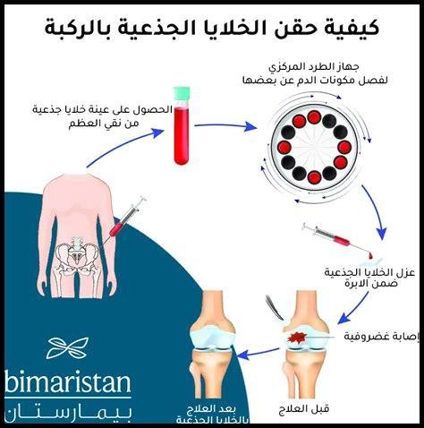 كيف تُستخدم الخلايا الجذعية في العلاج؟