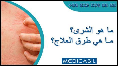 ما هي مميزات العيش في الظفرة