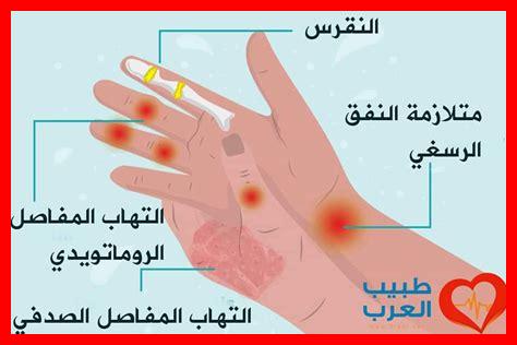 وجود رعشة في اليدين وجود رعشة في اليدين