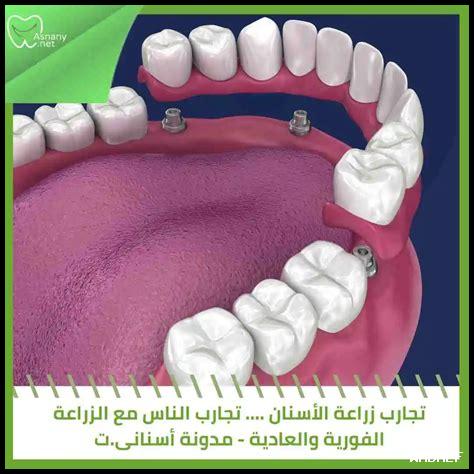 تجارب الناس مع إيميبرامين: تقييمات وآراء تجارب الناس مع إيميبرامين: تقييمات وآراء