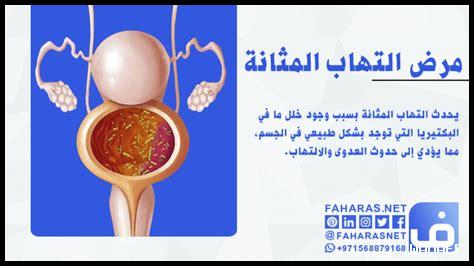 كيف يمكن الوقاية من التهابات المثانة؟