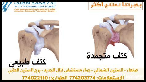 ما هو الفرق بين غليبيزيد وأدوية السكري الأخرى؟ ما هو الفرق بين غليبيزيد وأدوية السكري الأخرى؟