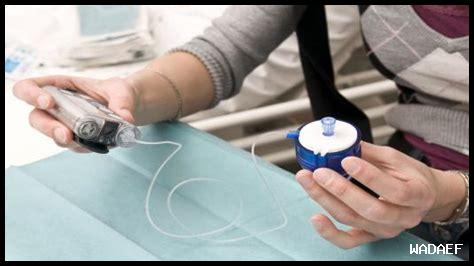 ما هي أحدث الابتكارات في الأنسولين؟ ما هي أحدث الابتكارات في الأنسولين؟